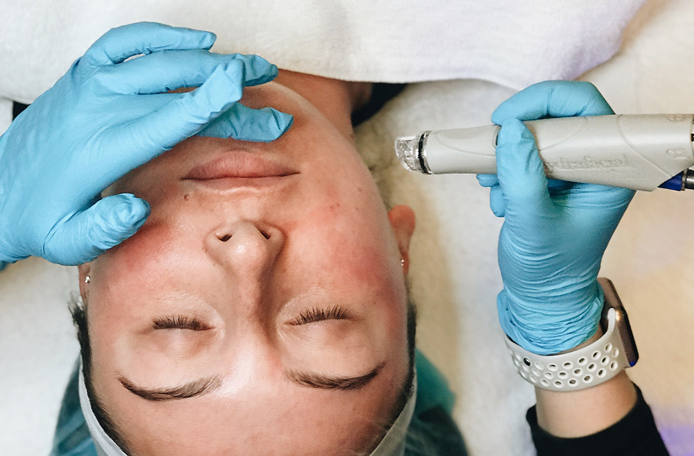 hydrafacial benefits